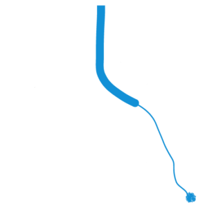 Lung Bronchoscopy