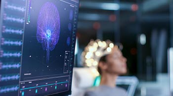 Electroencephalogram (EEG)